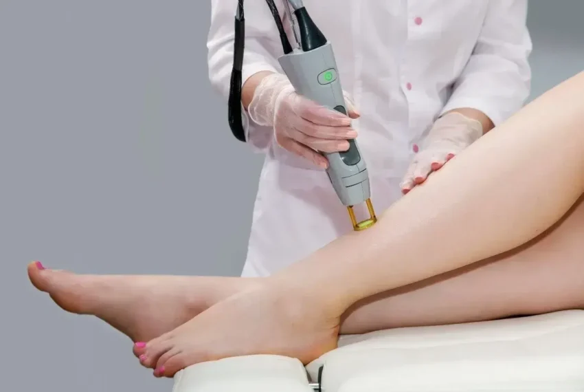 Laser Hair Removal